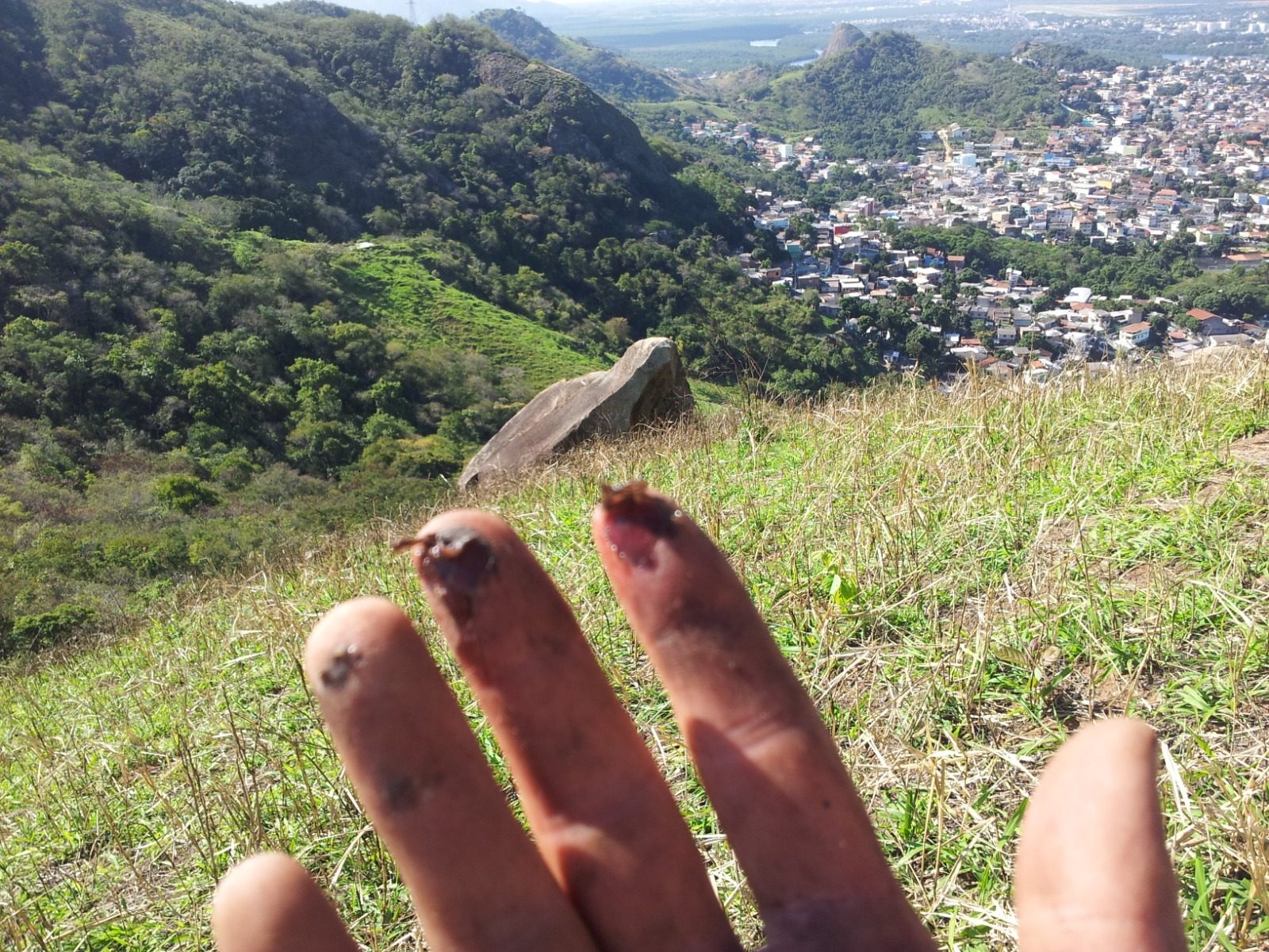 The damage — three shredded fingertips